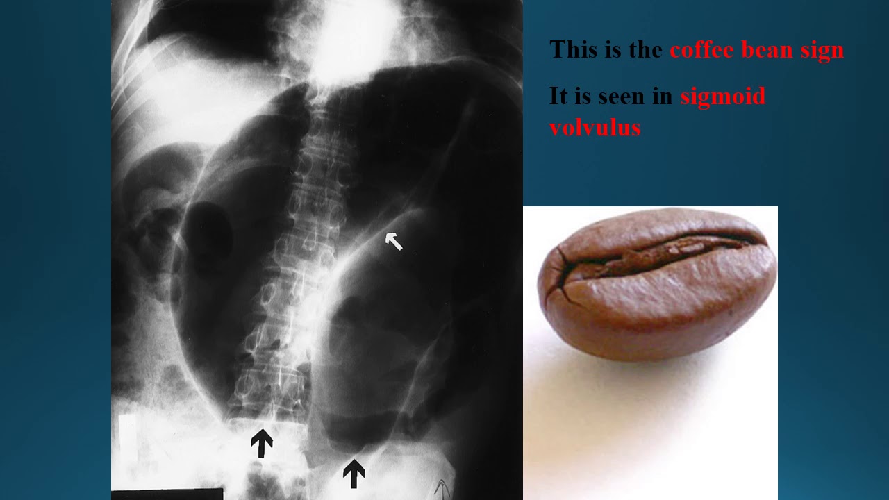 GIT imaging  Part 1| radiology | 5th grade | Dr. Sara Mahmoud