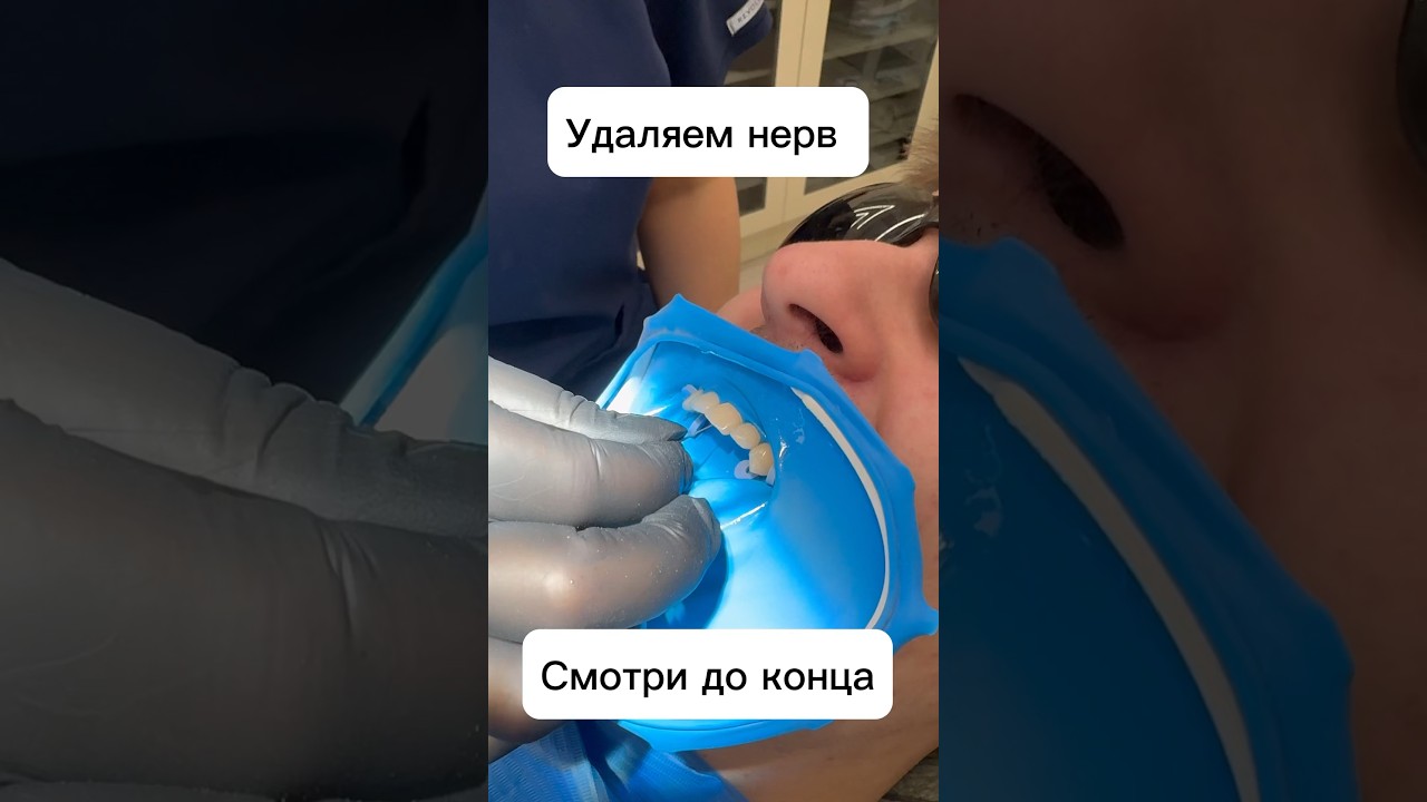 Удаление нерва из зуба, Подпишись! Новый контент каждый день 🦷