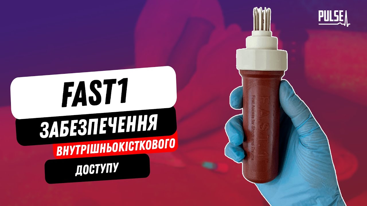 Забезпечення внутрішньокісткового доступу пристроєм FAST1