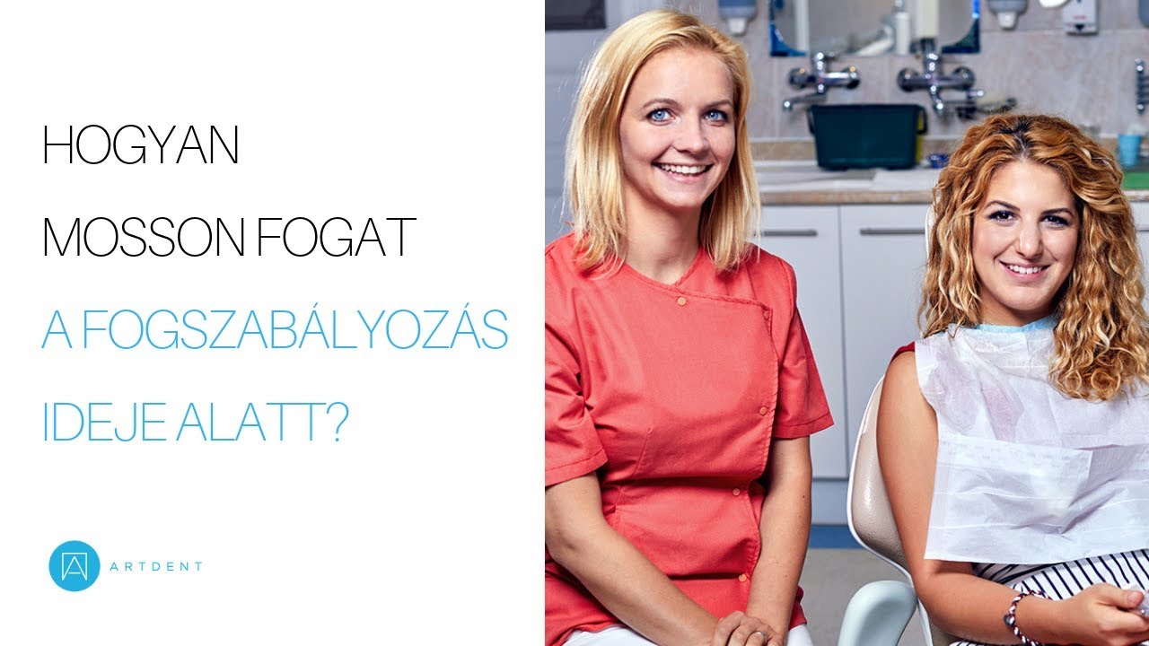 Hogyan mosson fogat a fogszabályozás ideje alatt?