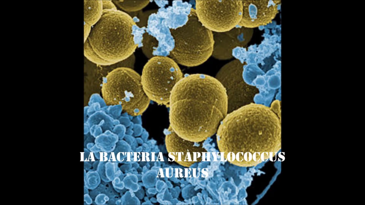 Foliculitis
