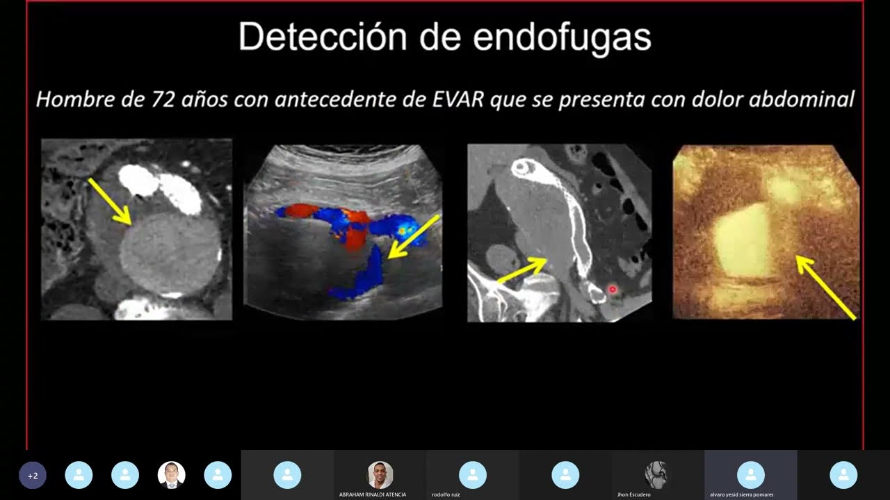 Angio Tomografia Dinámica