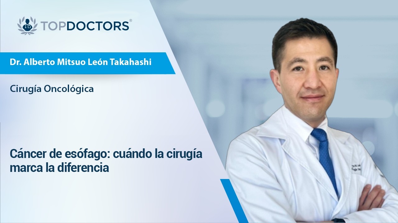 Cáncer de esófago: cuándo la cirugía marca la diferencia