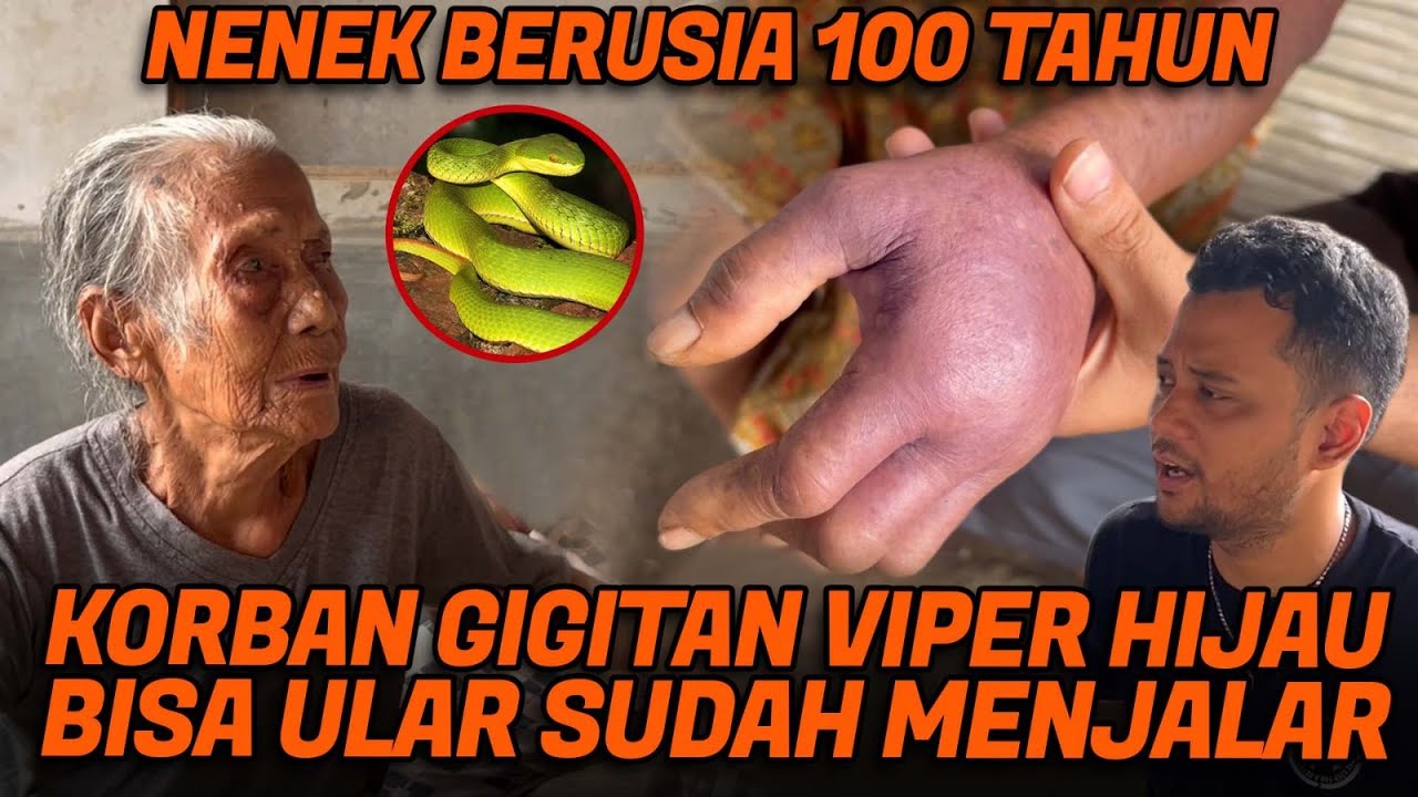 TOLONG NENEK KORBAN GIGITAN ULAR HIJAU EKOR MERAH!! USIANYA SERATUS TAHUN
