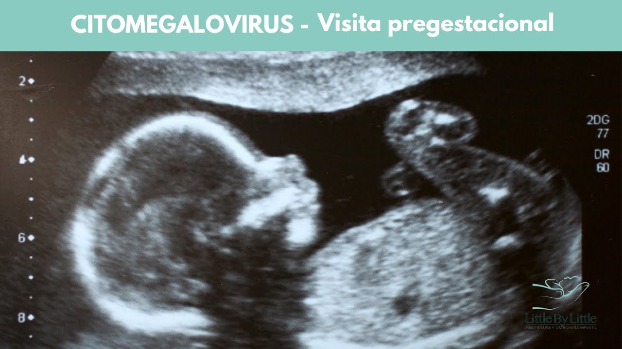 CITOMEGALOVIRUS - Visita pregestacional