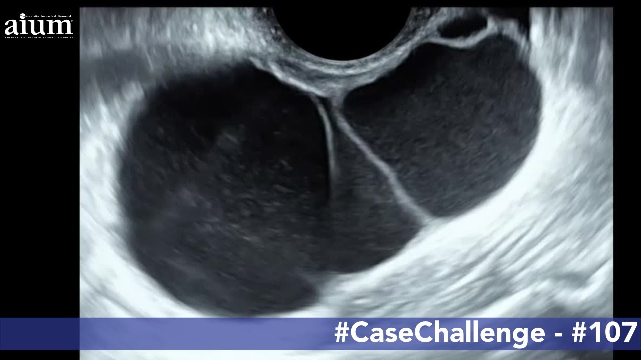 AIUM Case Challenge #107