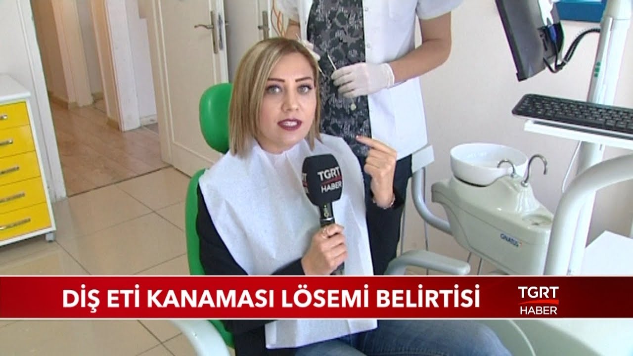 Diş Eti Kanaması Lösemi Belirtisi
