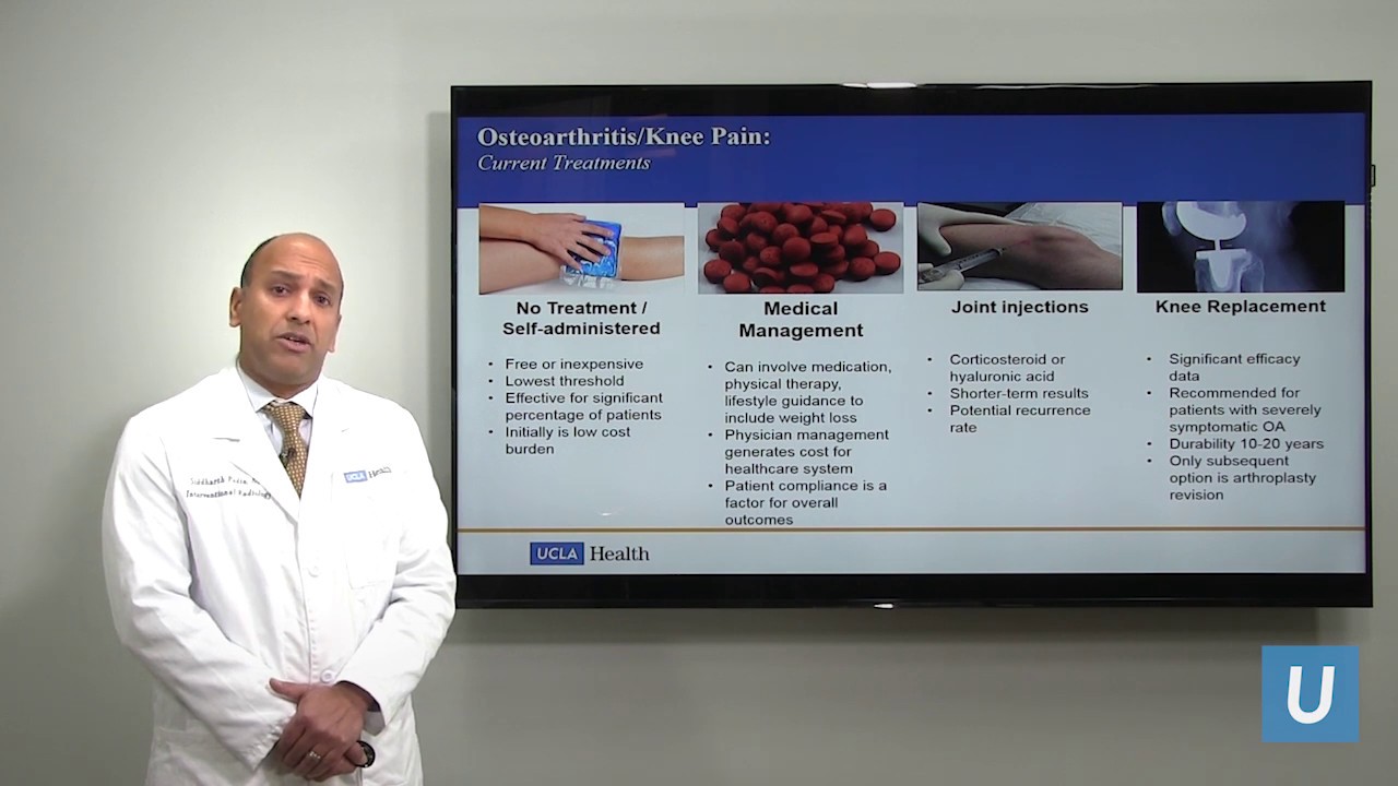 Genicular Artery Embolization for Knee Arthritis | Sid Padia, MD | UCLAMDChat