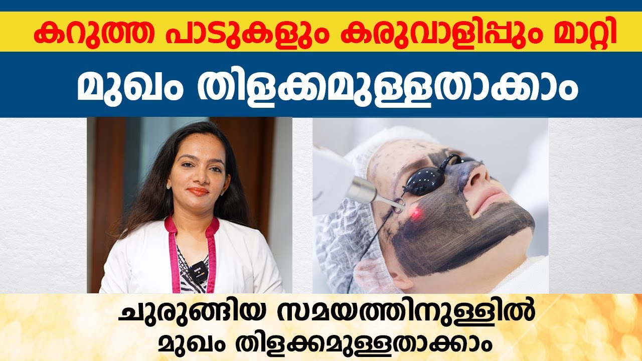മുഖം തിളക്കമുള്ളതാക്കാം ചുരുങ്ങിയ സമയത്തിനുള്ളിൽ | carbon peel for skin whitening