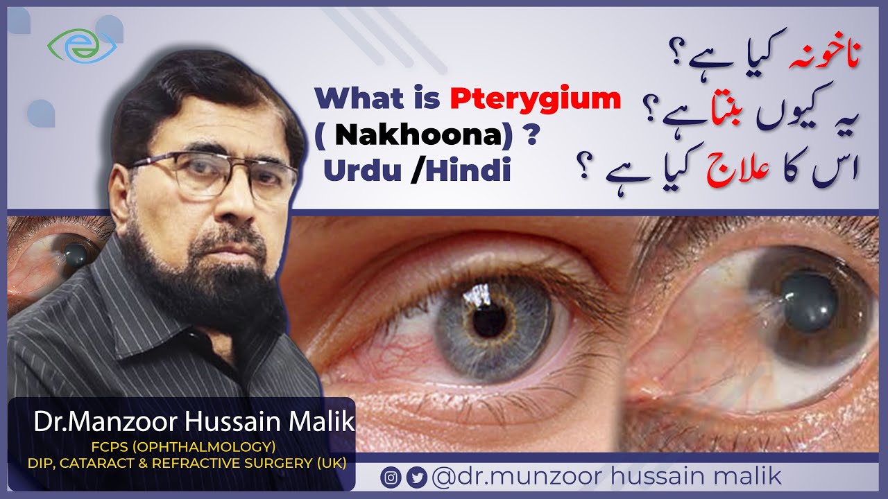 What is Pinguecula and Pterygium Prevention and Treatment