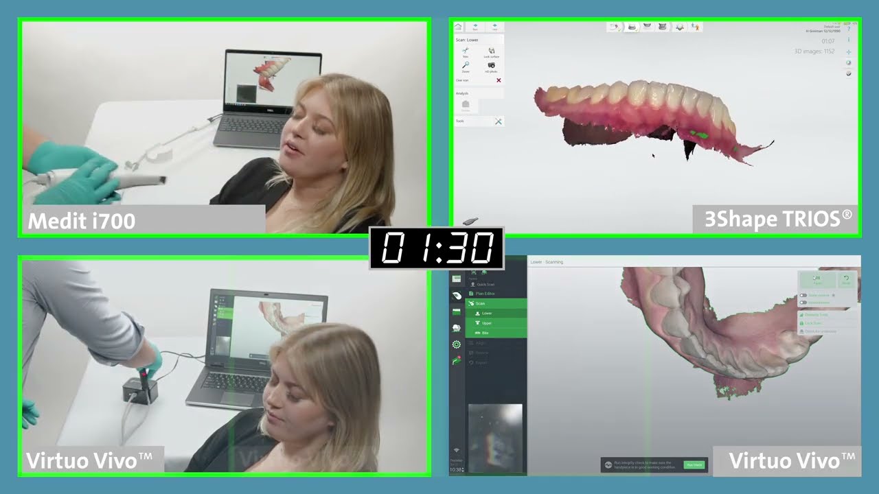 Intraoral Scanning Side by Side Comparison