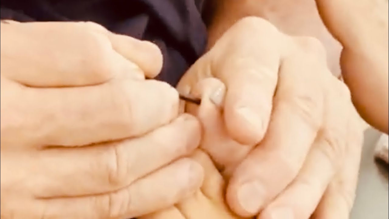 Foot reflexology massage. The importance of loosening the big toe & how to do it using massage tools
