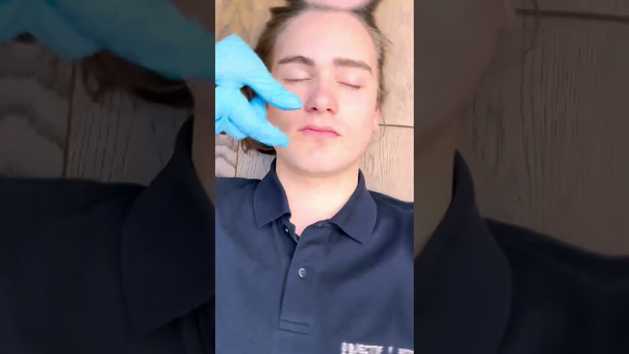 INSERTION OROPHARYNGEAL / GUEDEL AIRWAY #knowledge #MEDICAL #NURSE #airwaymanagement