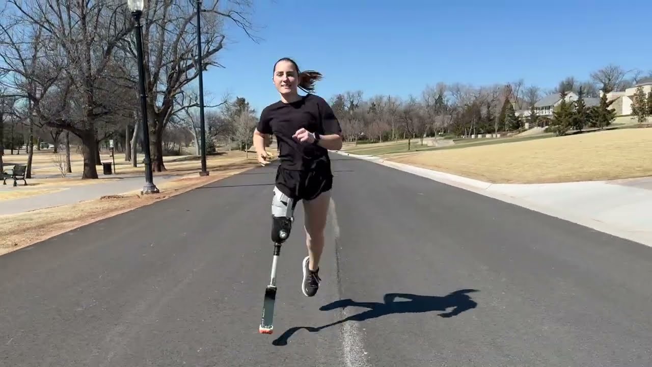 Slingshot Socket Testimonial - Allysa, AK User | Slingshot Bionics