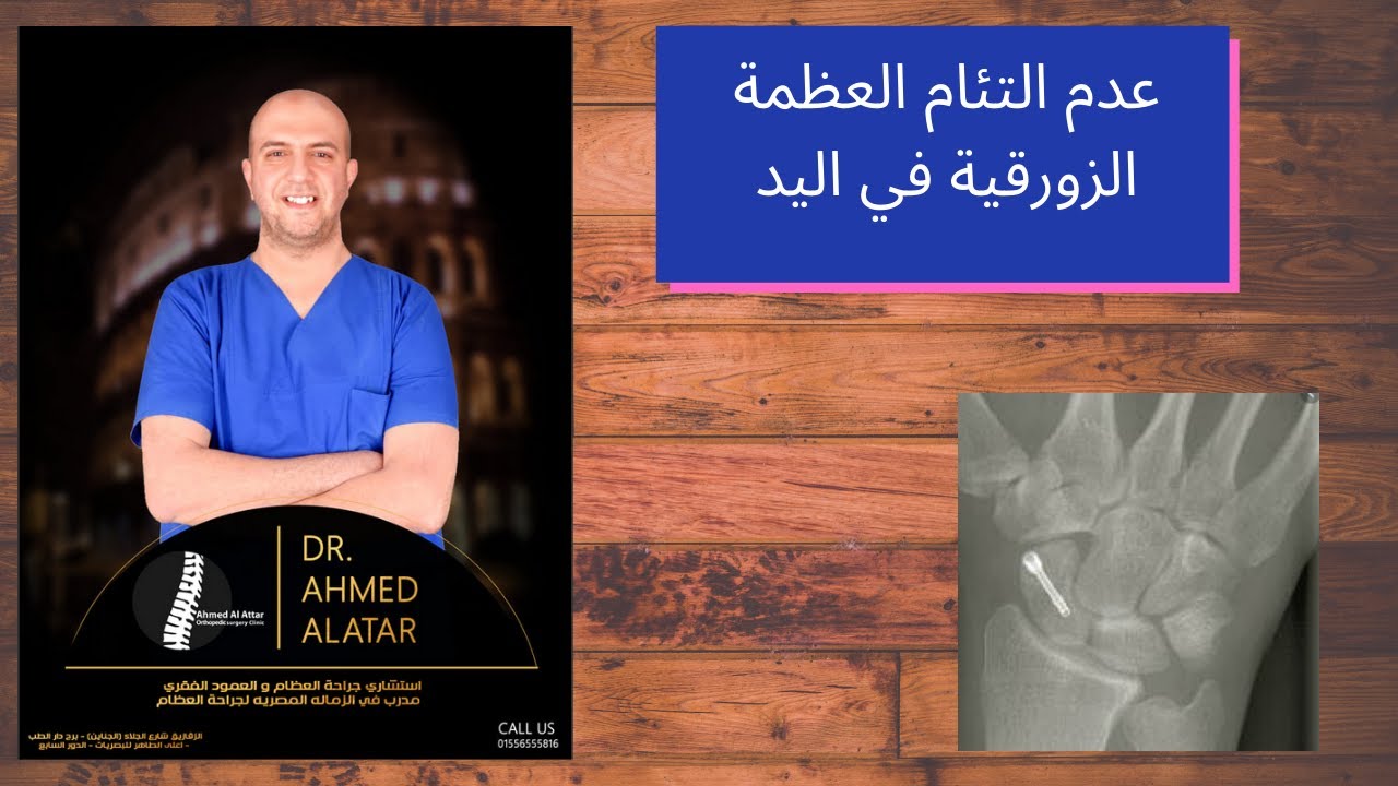 عدم التئام العظمة الزورقية في اليد - طرق التفكير في العلاج