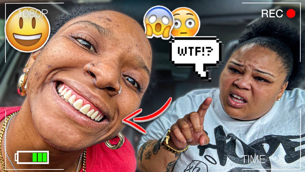 FAKE VENEERS REACTION ON FIANCÉ