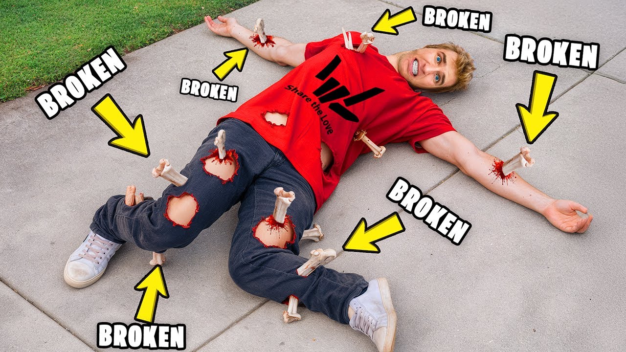 Breaking 67,421,690 Bones In ROBLOX!