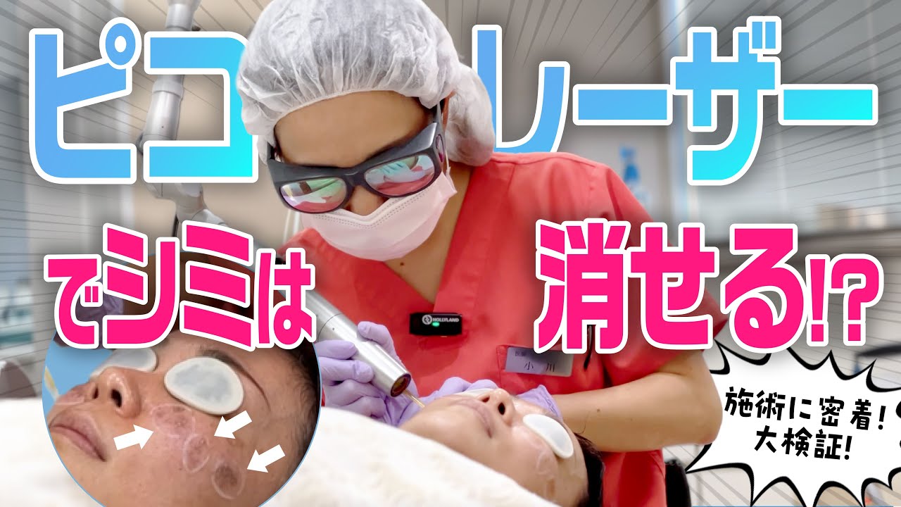 【大検証】大きなシミを取り除く！ピコレーザーの施術に密着＆解説！