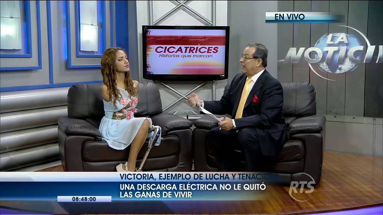 Cicatrices: Historia de superación de una joven afectada en sus extremidades