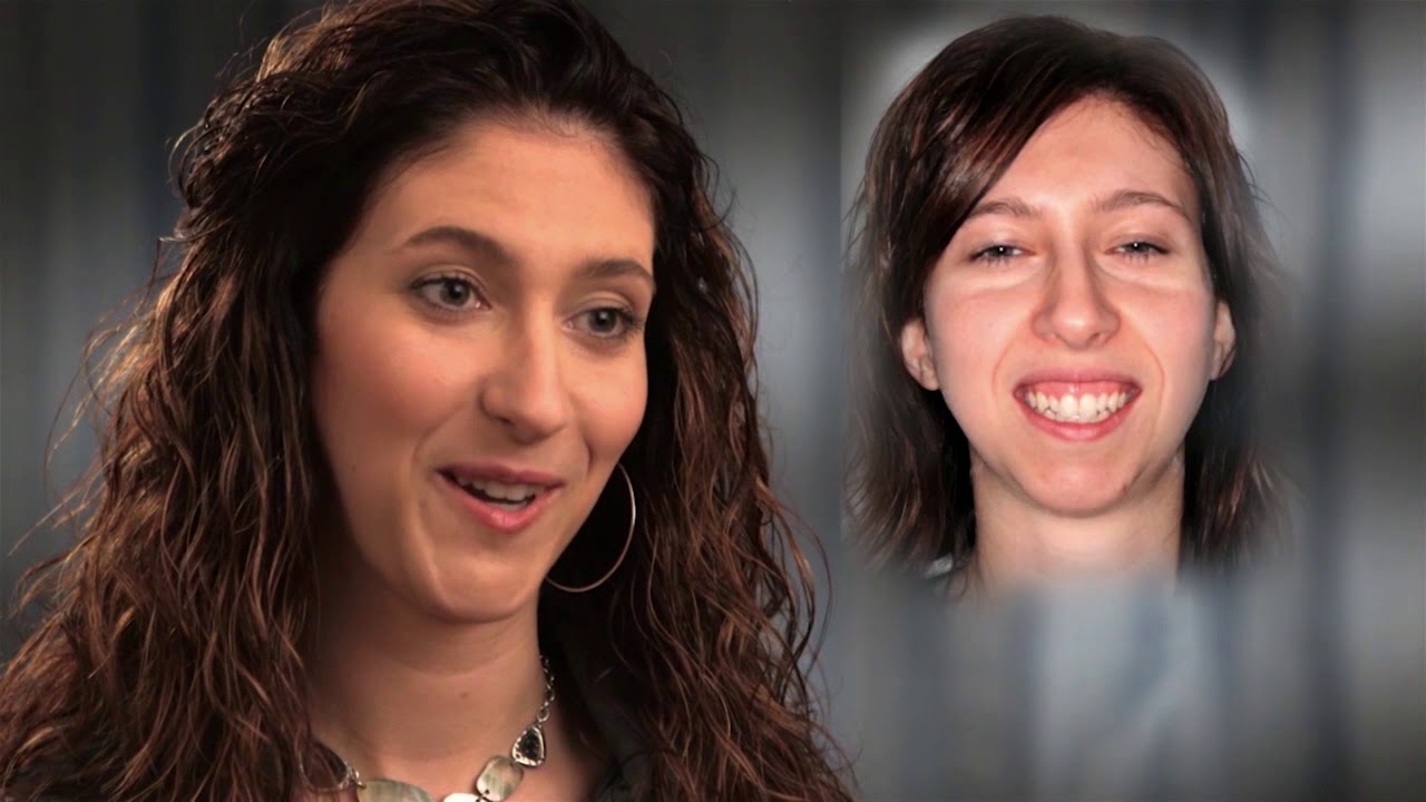 Traitements combin&eacute;s orthodontie et chirurgie de la m&acirc;choire