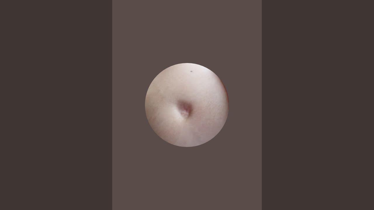 stomach growling channel  kanalı canlı yayında