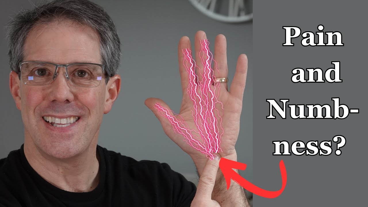 Carpal Tunnel Syndrome Treatment Recommendations (Self help)