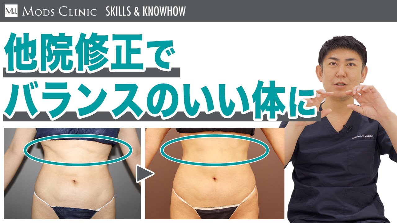 他院施術の修正事例について／北條誠至 医師｜Mods Clinic（モッズクリニック）