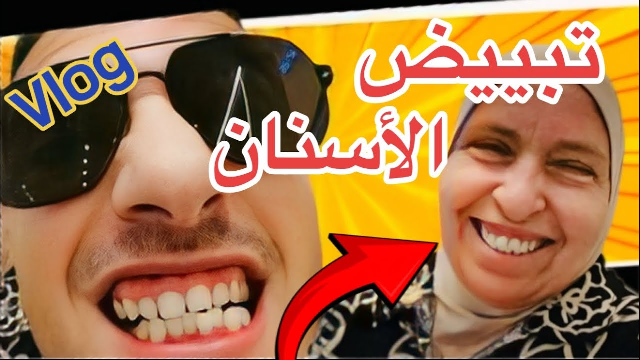 فلست في dentist تبييض الأسنان 💲⁉️  مع الوالدة 