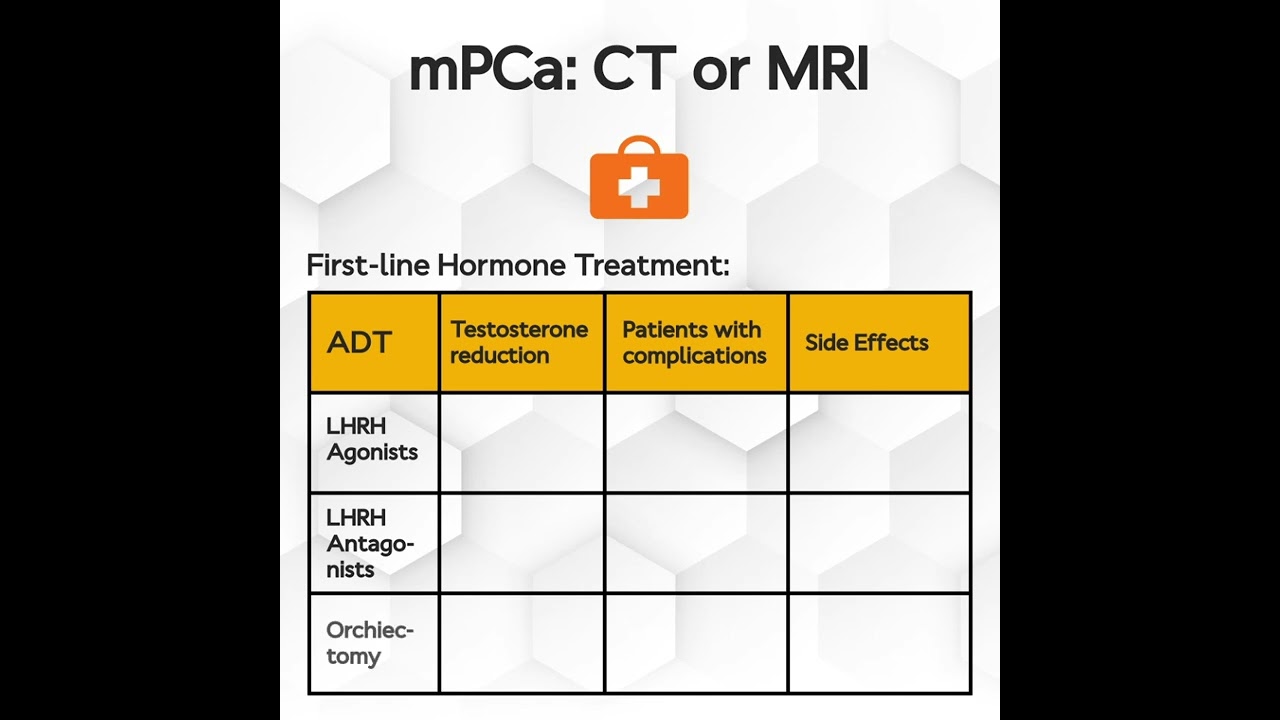 SPOTLIGHT video | EAU Prostate Cancer Guideline part 2