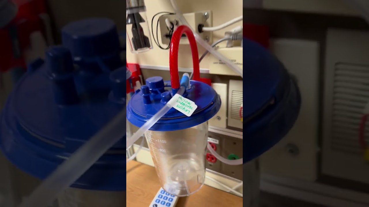 Continuous Subglottic Suction