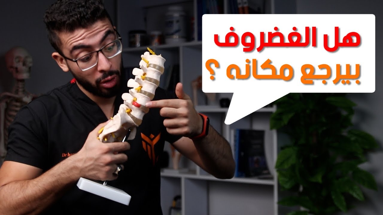 هل الغضروف بيرجع مكانه ؟ (Q &A)