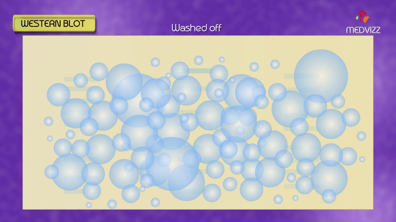 Western blot , Southern blot , Northern blot , South western Blot - Animation