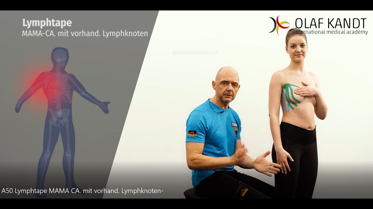 Lymphtape Mamma-ca  mit vorhandenen Lymphknoten