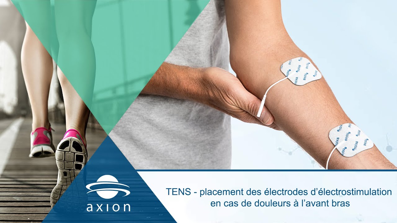 TENS - placement des électrodes d’électrostimulation en cas de douleurs à l’avant bras