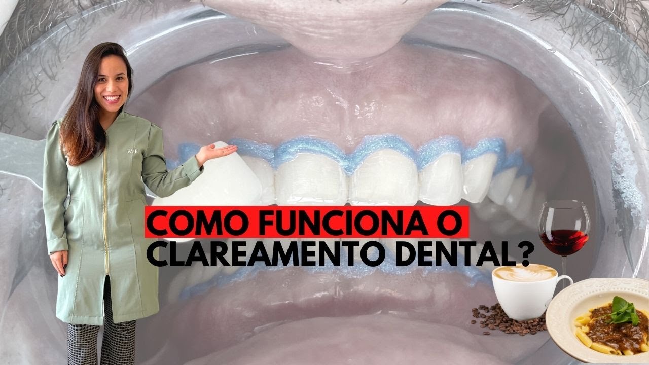 Como Funciona o Clareamento Dental?