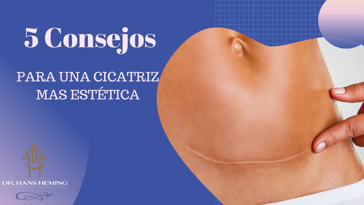 ¿Cómo borrar cicatrices de cirugía? 5 Pasos para que NO quede marca
