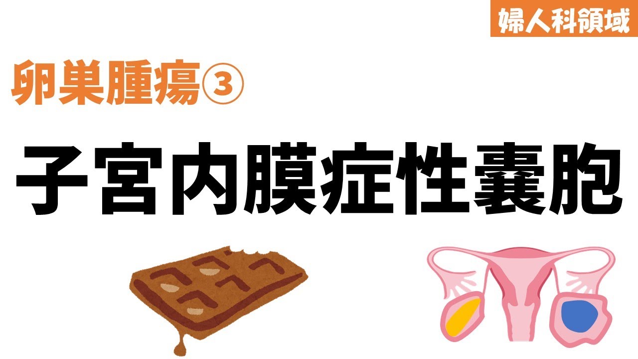 【卵巣腫瘍③】破裂！？がん化！？子宮内膜症性嚢胞、チョコレート嚢胞の原因と治療法について解説【婦人科】