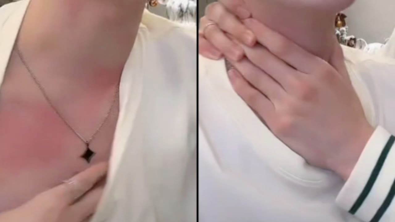 [Gay/BL] Поиск преступника, оставившего следы на шее Чена Лв | Чен Лв и Лю Конг