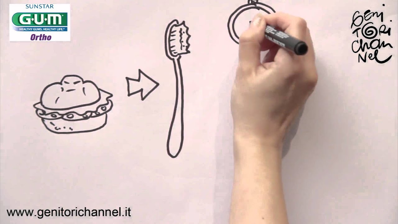 Consigli per la pulizia dei denti e dell'apparecchio ortodontico