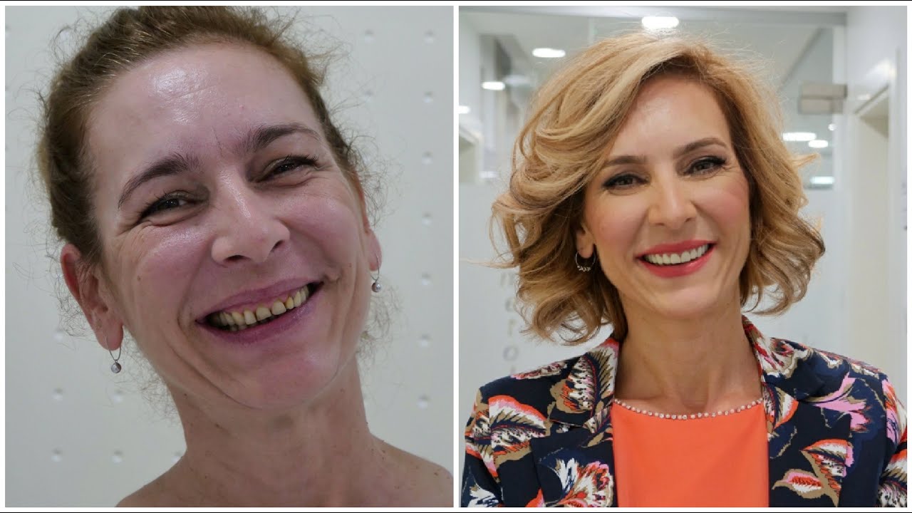 MAKEOVER SA PET ZVJEZDICA! (Klinika S Tetik Banja Luka)