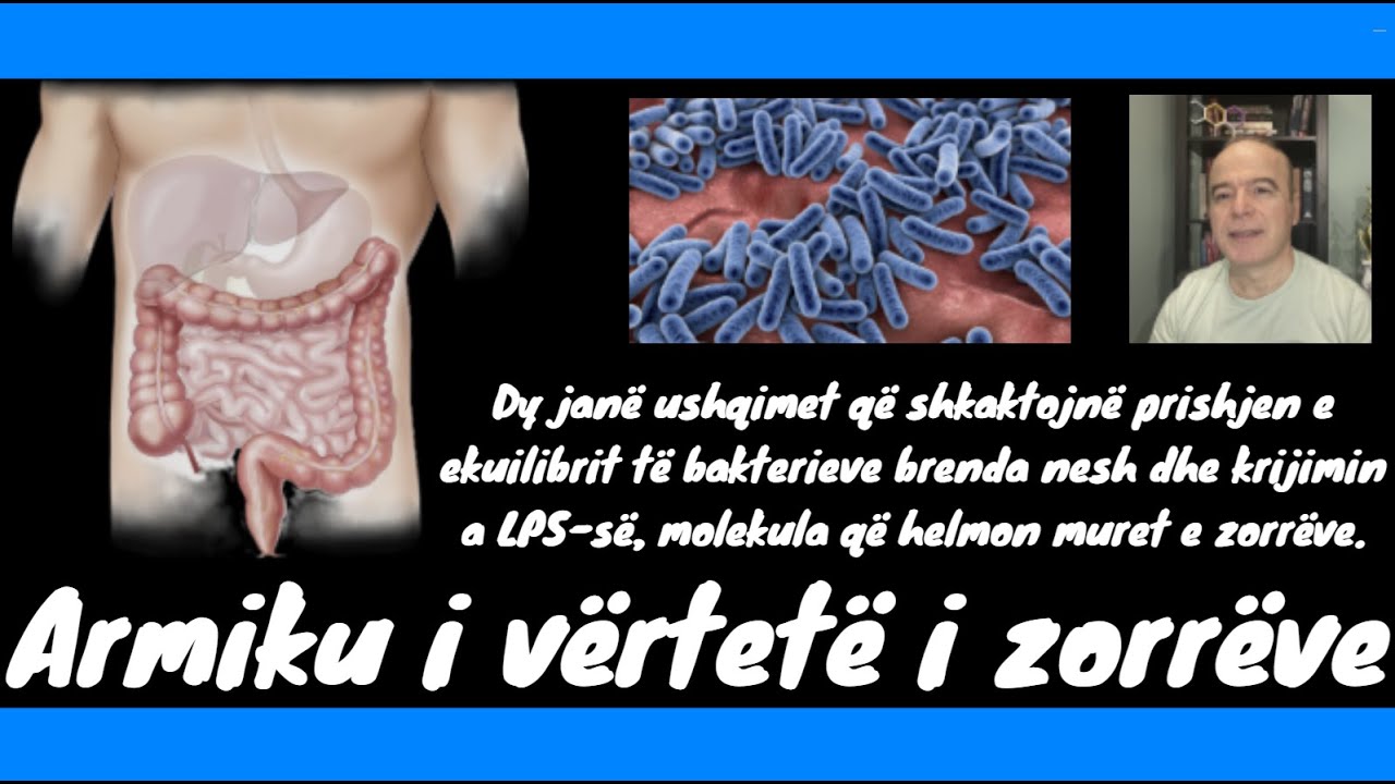 Armiku i vërtetë i zorrëve dhe ushqimet që e stimulojnë atë.