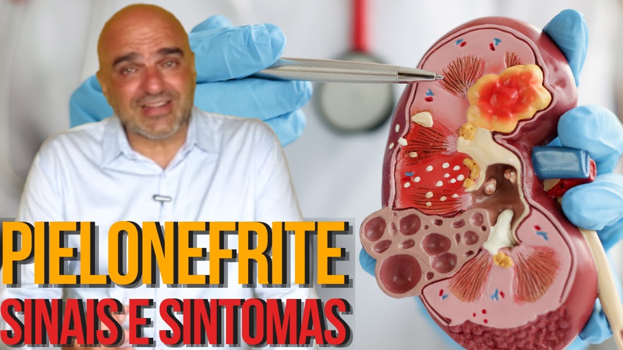 INFEC&Ccedil;&Atilde;O dos RINS: o que &eacute; pielonefrite? O que causa? Quais os sintomas? Como tratar?