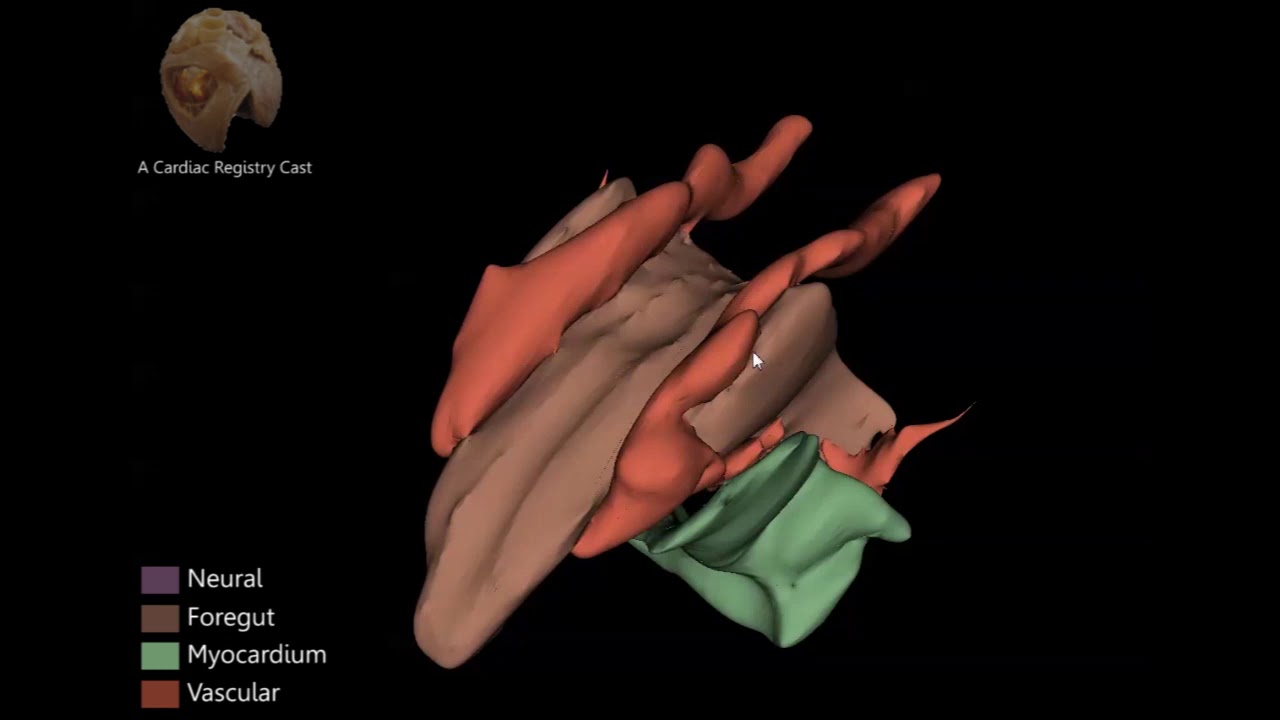 Cardiac embryology - Carnegie Stage 9 - Stephen Sanders, MD
