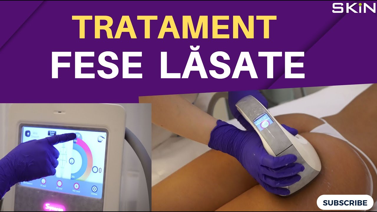 Fese mai ferme, fără celulită🍑VelaShape III🥇Cel mai popular tratament anticelulitic din lume💚SKiN