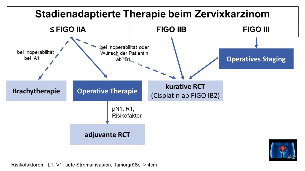 Stadienadaptierte Therapie beim Zervixkarzinom (bis FIGO III) | Strahlentherapie Prof. Hilke Vorwerk