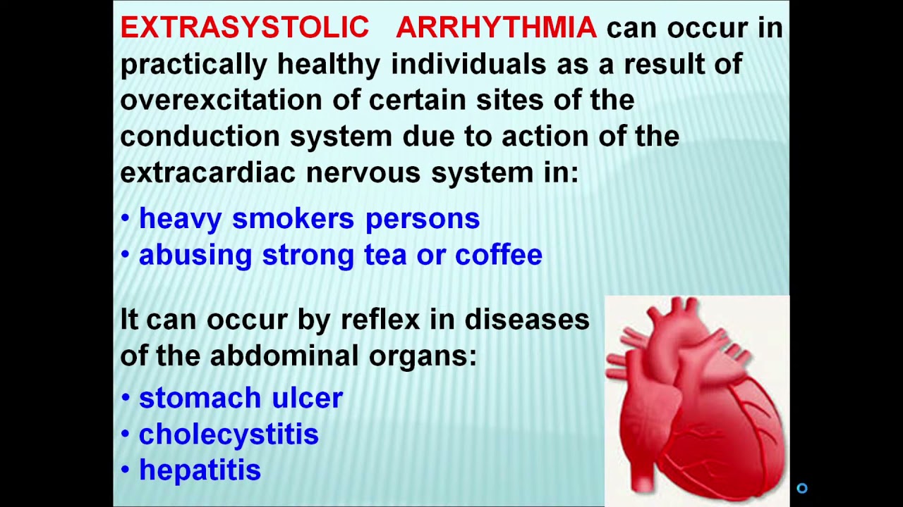 13:50 CLINICAL  AND ECG  DIAGNOSTIC  OF  THE  ARRHYTHMIAS