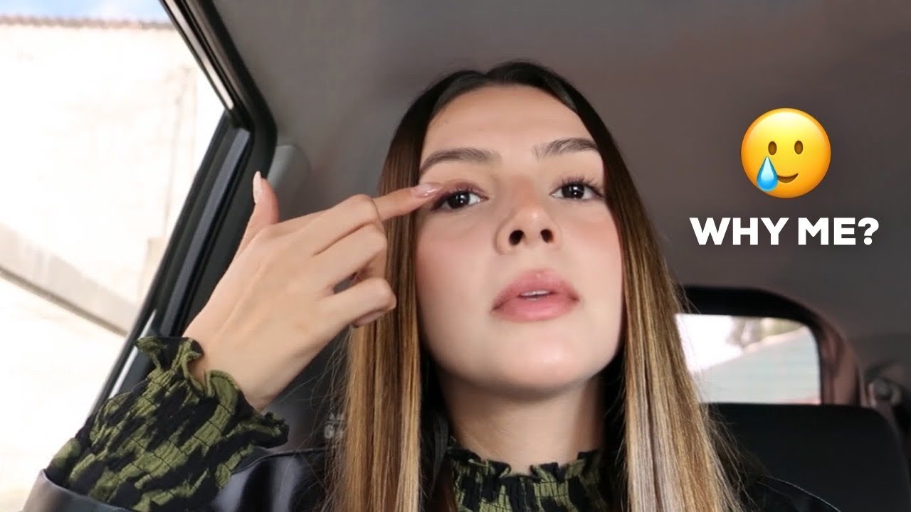 ME OPERARON MI OJO | Vlog
