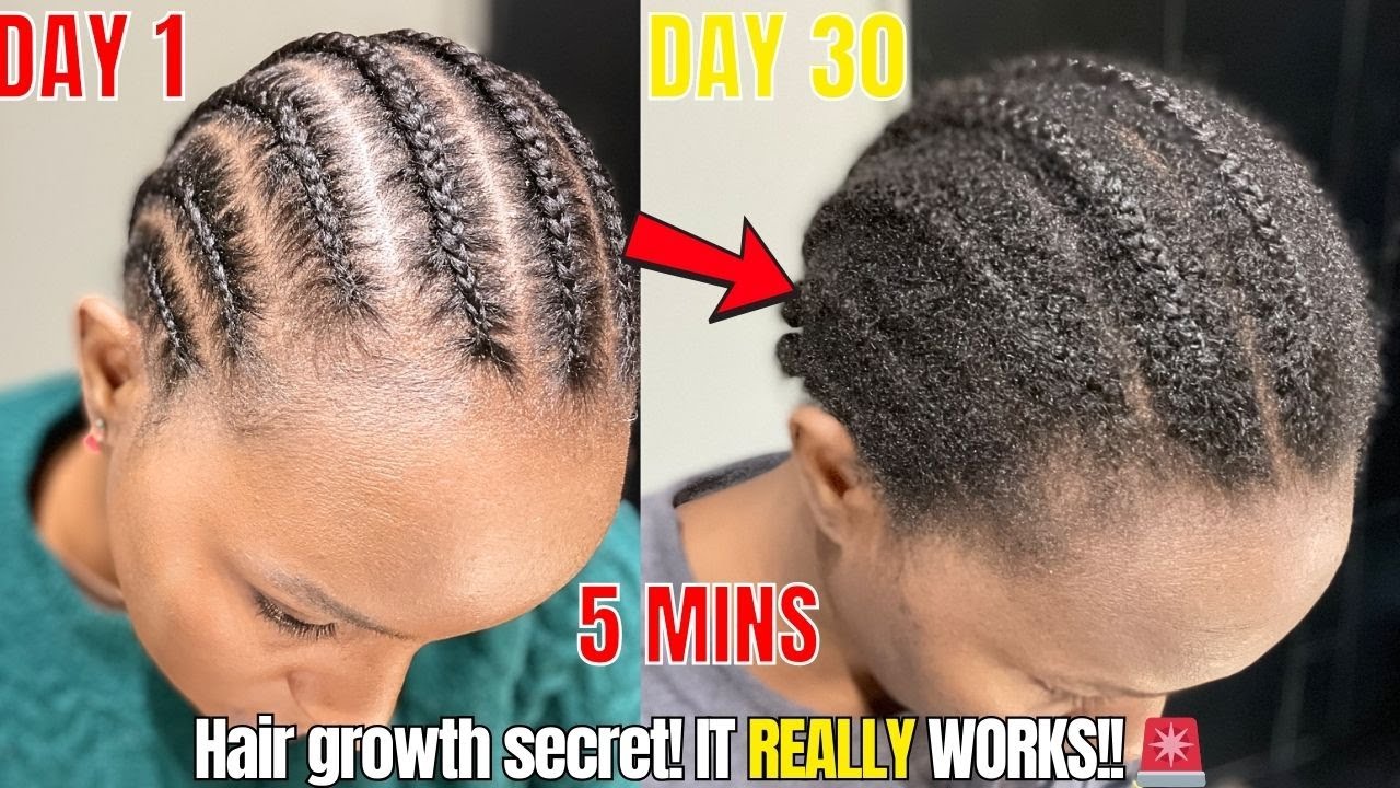🔥30 Days To Thicker, Healthier Hair Growth 🌱 😱 | The Best Hair Growth Tip😲 ✅