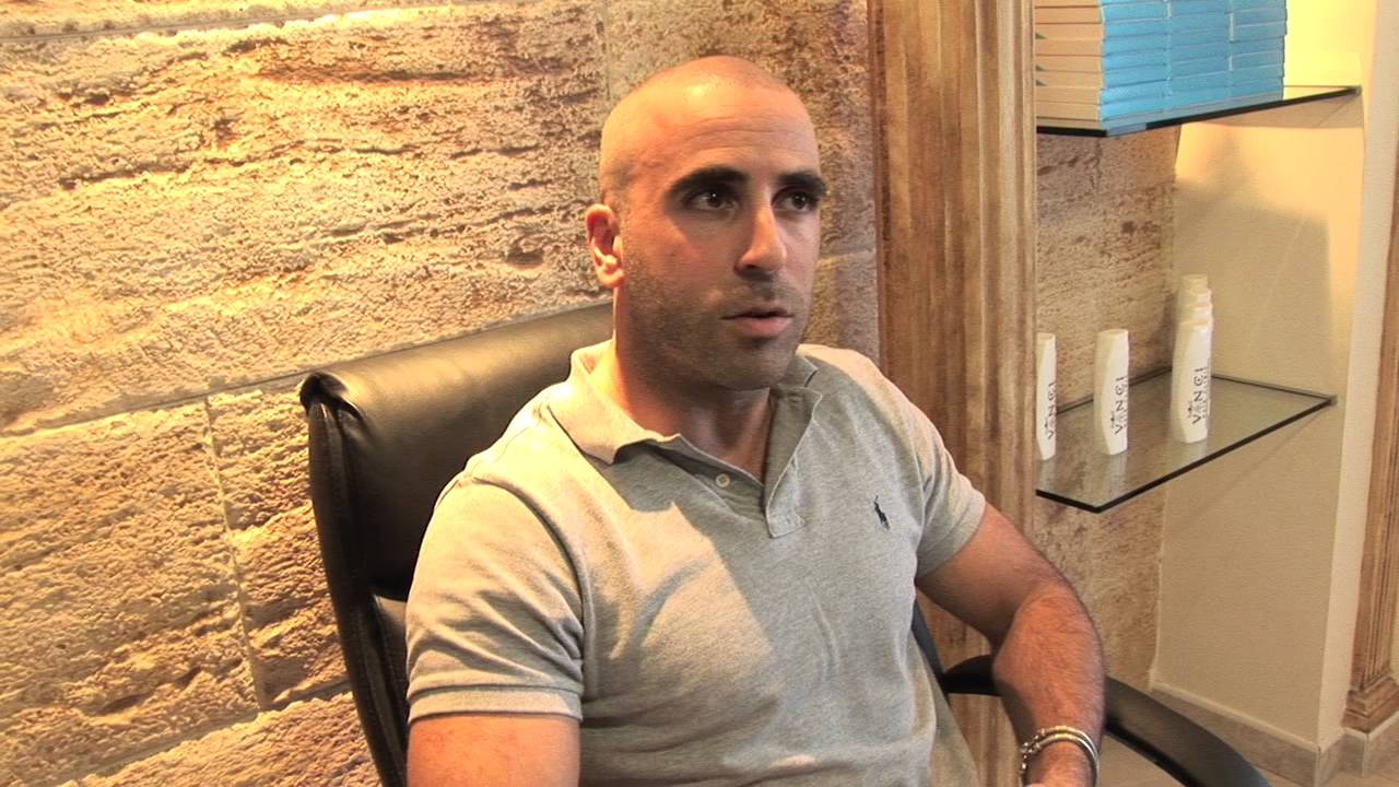 Vinci Hair Clinic - Scalp Micropigmentation Client