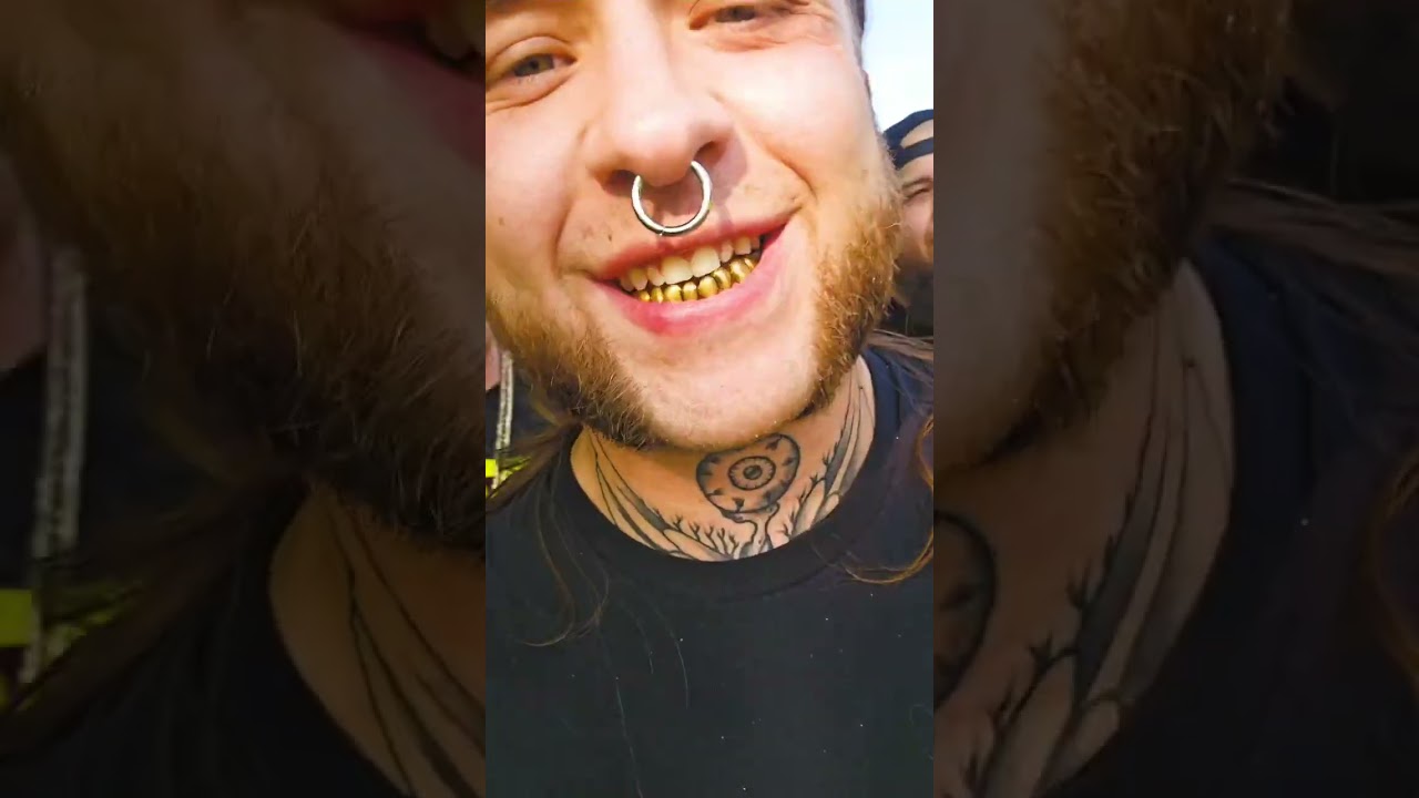 44OH 